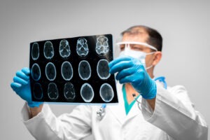 Las Vegas Brain Injury Lawyer: Doctor examining a brain MRI scan